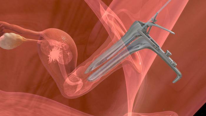 embryo transfer procedure